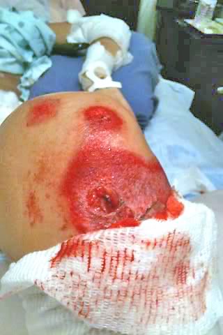 Name: rash2.jpg
Views: 209
Size: 23.8 KB