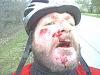 I Crashed Today, but fortunately not on my VTR-face-plant-2c.jpg