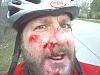 I Crashed Today, but fortunately not on my VTR-face-plant-crash-1c.jpg