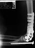 I'm a dumba$$ who lowsided....-elbow1.jpg