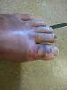 No more riding this year-toe.jpg