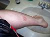 Superhawk forum needs a hall of shame (Warning: scar)-100_1866.jpg