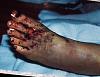 Superhawk forum needs a hall of shame (Warning: scar)-wreck4.jpg