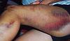 Superhawk forum needs a hall of shame (Warning: scar)-wreck6.jpg